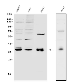 Transcription factor MafA MAFA Rabbit Polyclonal Antibody