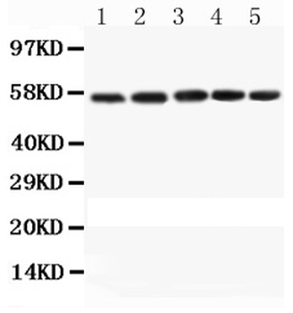 Caspase-8/CASP8 Rabbit Polyclonal Antibody