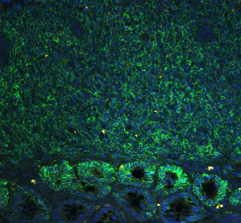 CD44 Rabbit Polyclonal Antibody