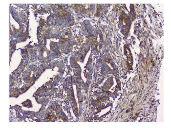 N myc interactor/NMI Antibody
