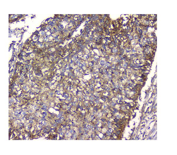 N myc interactor/NMI Antibody