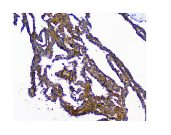 N myc interactor/NMI Antibody