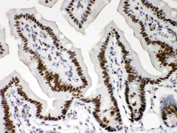 Nucleophosmin/NPM1 Rabbit Polyclonal Antibody