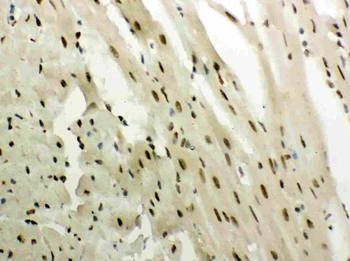 Glucocorticoid Receptor/NR3C1 Antibody