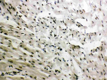 Glucocorticoid Receptor/NR3C1 Antibody