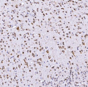 Optineurin/OPTN Antibody