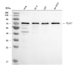 TPA Tissue Plasminogen Activator/PLAT Rabbit Polyclonal Antibody
