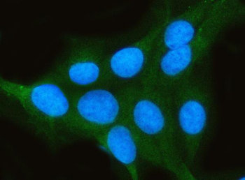 PP2A-alpha/PPP2CA/PP2A Rabbit Polyclonal Antibody