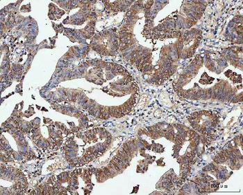 PP2A-alpha/PPP2CA/PP2A Rabbit Polyclonal Antibody