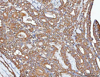 PP2A-alpha/PPP2CA/PP2A Rabbit Polyclonal Antibody