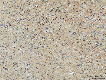 PP2A-alpha/PPP2CA/PP2A Rabbit Polyclonal Antibody