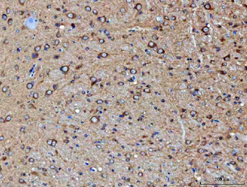 PP2A-alpha/PPP2CA/PP2A Rabbit Polyclonal Antibody