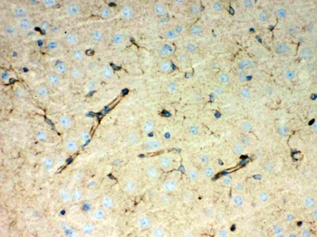 Peroxiredoxin 1/PRDX1 Antibody