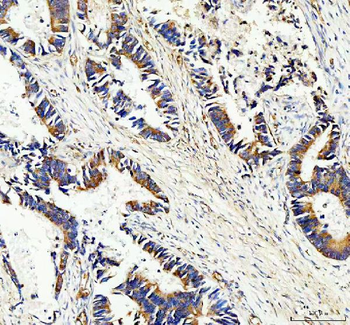 MASPIN/SERPINB5 Antibody