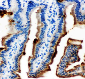 MASPIN/SERPINB5 Antibody