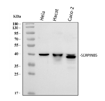 MASPIN/SERPINB5 Antibody