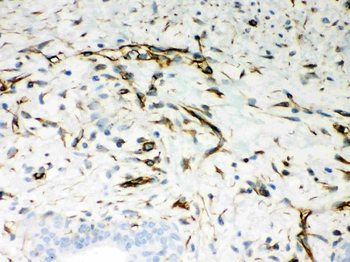 Vimentin Antibody