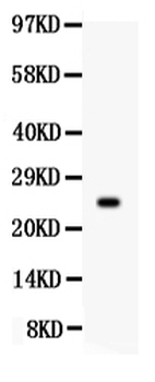 Prolactin/PRL Rabbit Polyclonal Antibody