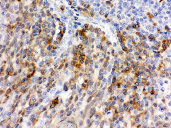 CD62P/SELP Rabbit Polyclonal Antibody