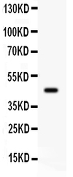 beta 2 Adrenergic Receptor/ADRB2 Rabbit Polyclonal Antibody