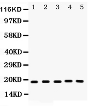 Caspase-2/CASP2 Rabbit Polyclonal Antibody