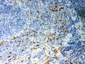 CD36 Rabbit Polyclonal Antibody