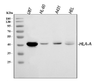 HLA A/HLA-A Rabbit Polyclonal Antibody