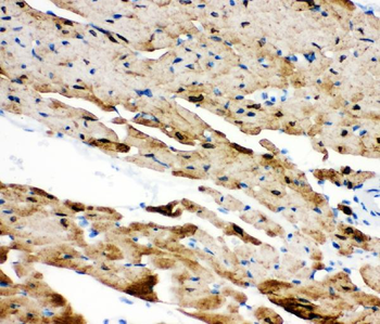 Phospholamban/PLN Rabbit Polyclonal Antibody