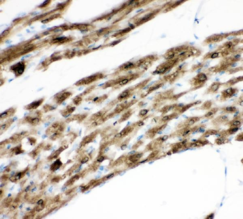 Phospholamban/PLN Rabbit Polyclonal Antibody