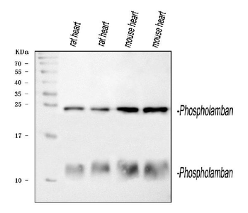 Phospholamban/PLN Rabbit Polyclonal Antibody