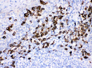 Peroxiredoxin 4/PRDX4 Antibody