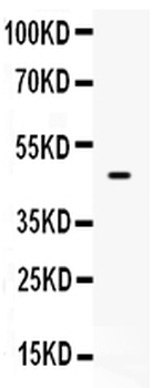 PTEN Rabbit Polyclonal Antibody