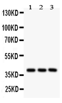 Prostaglandin E Receptor EP2/PTGER2 Rabbit Polyclonal Antibody