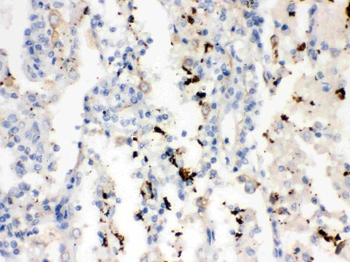 SFTPA1/2 Antibody