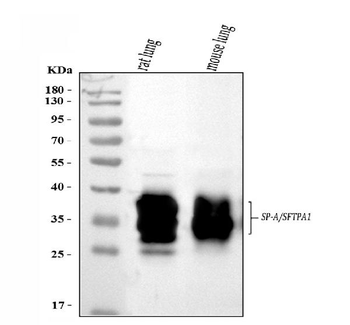 SFTPA1/2 Antibody