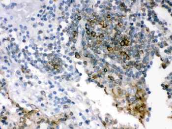 SHC/SHC1 Rabbit Polyclonal Antibody