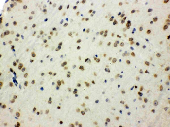 SHC/SHC1 Rabbit Polyclonal Antibody