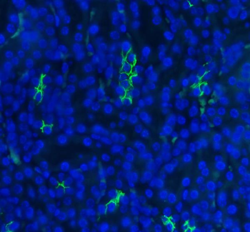 SLC12A1 Rabbit Polyclonal Antibody