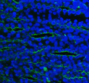 SLC12A1 Rabbit Polyclonal Antibody