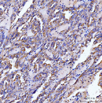 SLC12A1 Rabbit Polyclonal Antibody