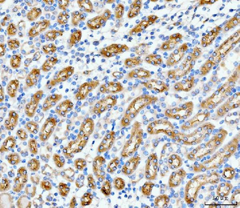 SLC12A1 Rabbit Polyclonal Antibody