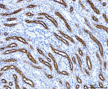 SLC12A1 Rabbit Polyclonal Antibody