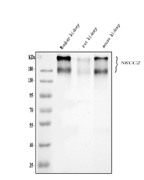 SLC12A1 Rabbit Polyclonal Antibody