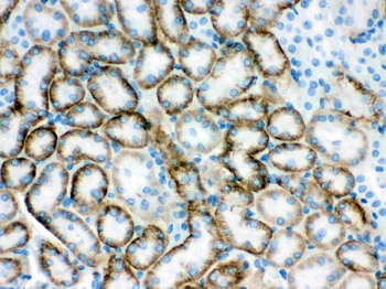 SLC22A2 Rabbit Polyclonal Antibody