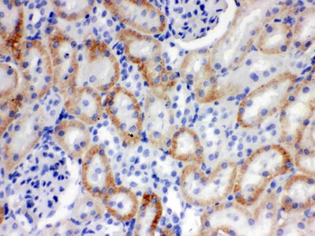 SLC22A2 Rabbit Polyclonal Antibody