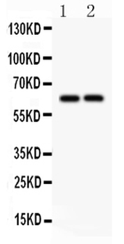 SLC22A2 Rabbit Polyclonal Antibody