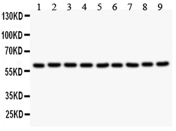 Smad4 Rabbit Polyclonal Antibody