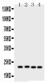 SOCS2 Rabbit Polyclonal Antibody