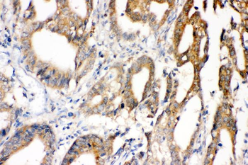 Superoxide Dismutase 1/SOD1 Antibody