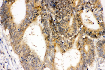 Superoxide Dismutase 1/SOD1 Antibody